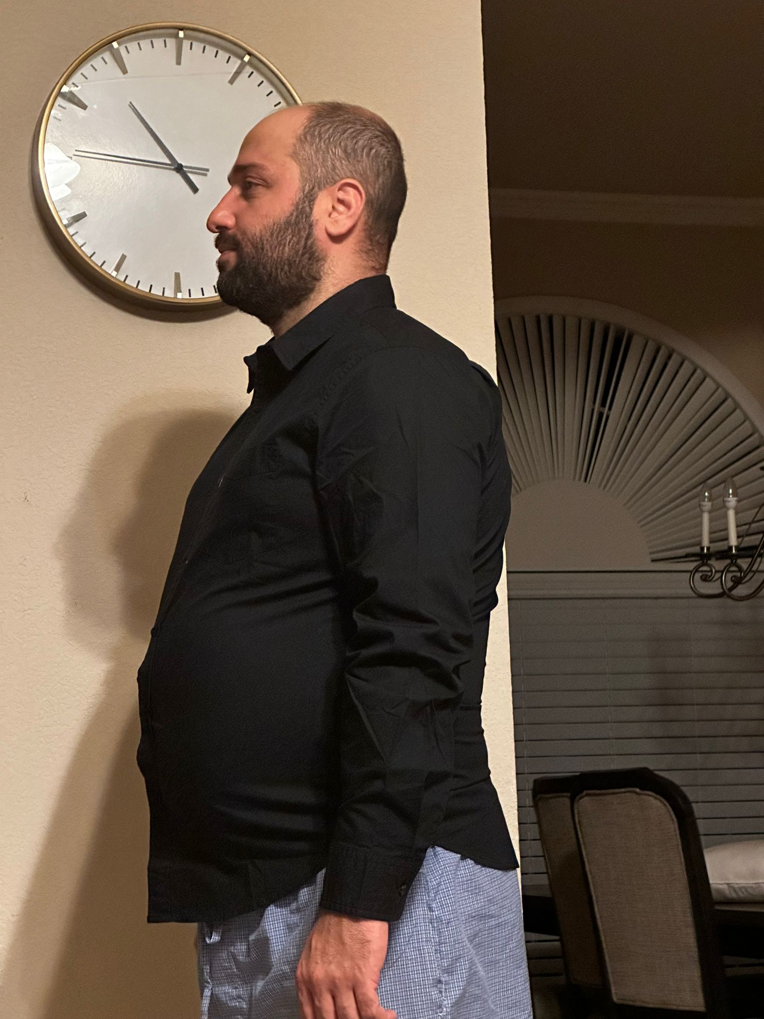 Before transformation